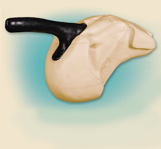 SNI-2